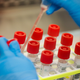 A lab technician prepares covid-19 patient samples for testing.